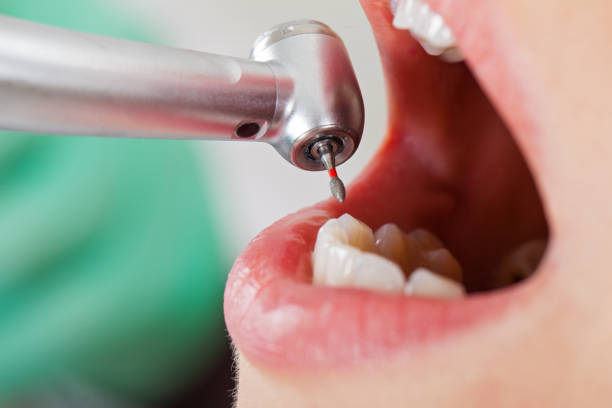 Best Emergency Treatment for Toothache in Powdersville, SC